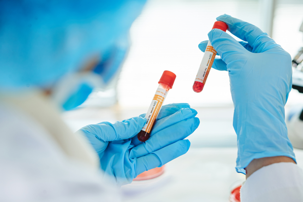 rapid test vs PCR